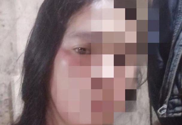 Korban penganiayaan dan pengeroyokan, Inaya (38)
