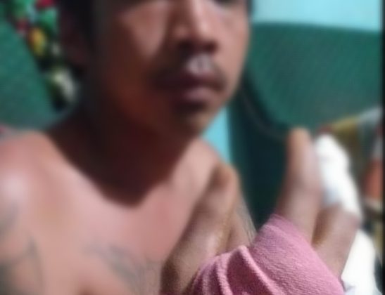 WB (33) Pria korban pembacokan di Pancur Batu